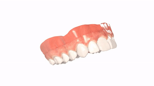 teeth Image